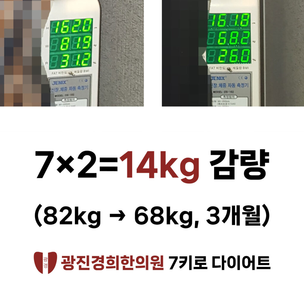 다이어트클리닉 광진경희한의원|7k 다이어트 방법